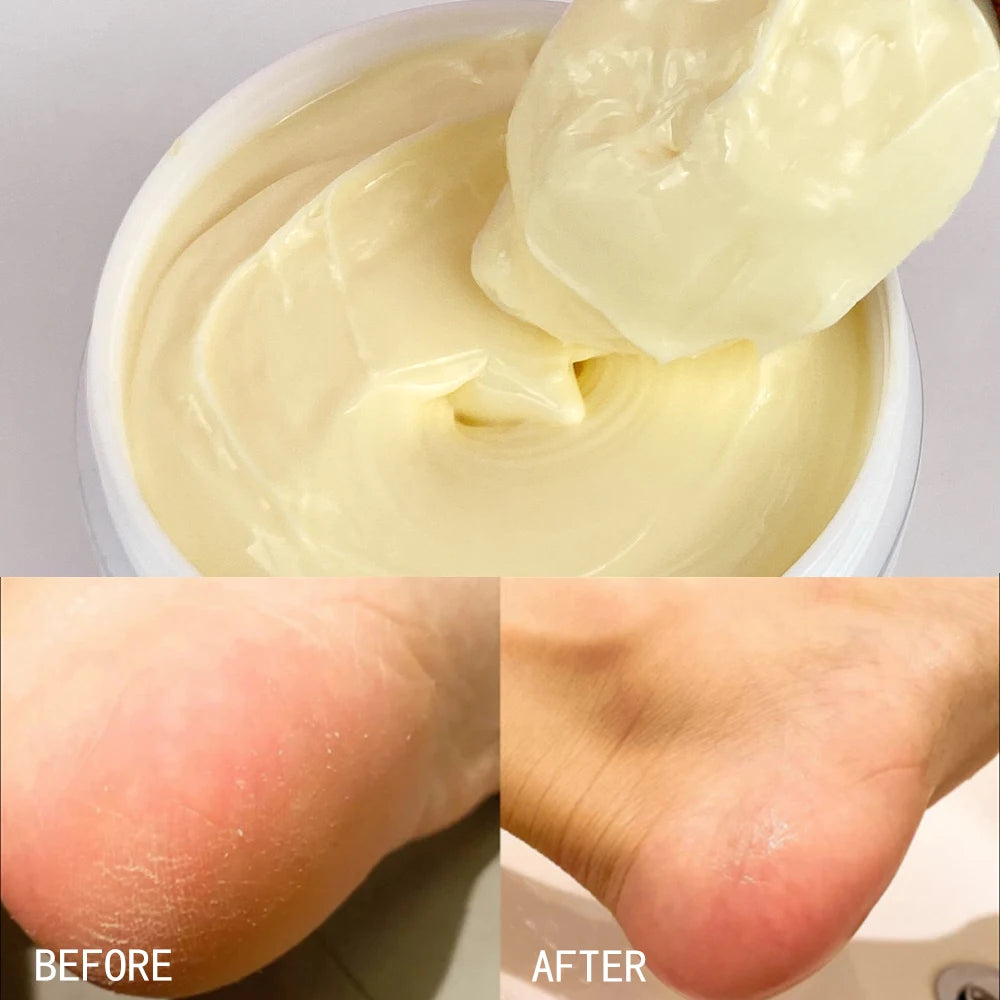 Organic Shea Butter Whitening Body Cream for Dark Skin